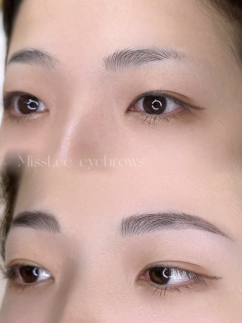 飄霧眉結合案例